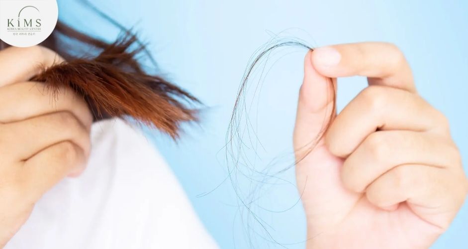 Tìm hiểu nguyên nhân gây rụng tóc trước khi quyết định sử dụng thuốc