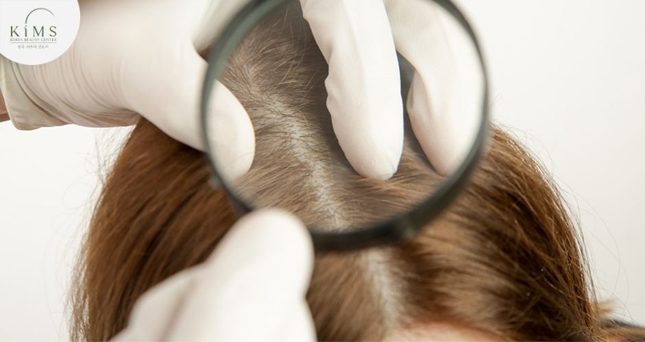 Bác sĩ chẩn đoán nguyên nhân rụng tóc trước khi kê thuốc