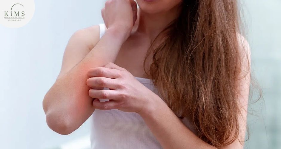 Triệu chứng ngứa ngáy, phát ban cần liên hệ lập tức với bác sĩ